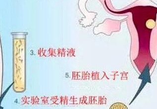 2026年广西做三代试管婴儿需要多少钱？附试管婴儿费用明细